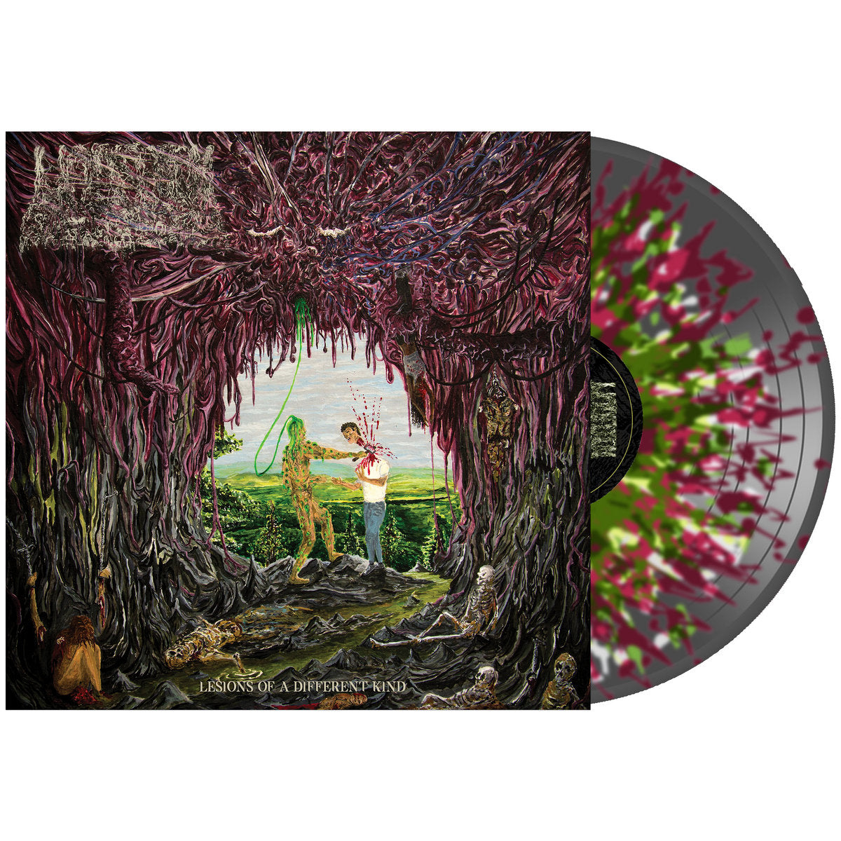 UNDEATH 'LESIONS OF A DIFFERENT KIND' LP - CLEAR BLACK/MAROON/GREEN/WHITE/SPLATTER