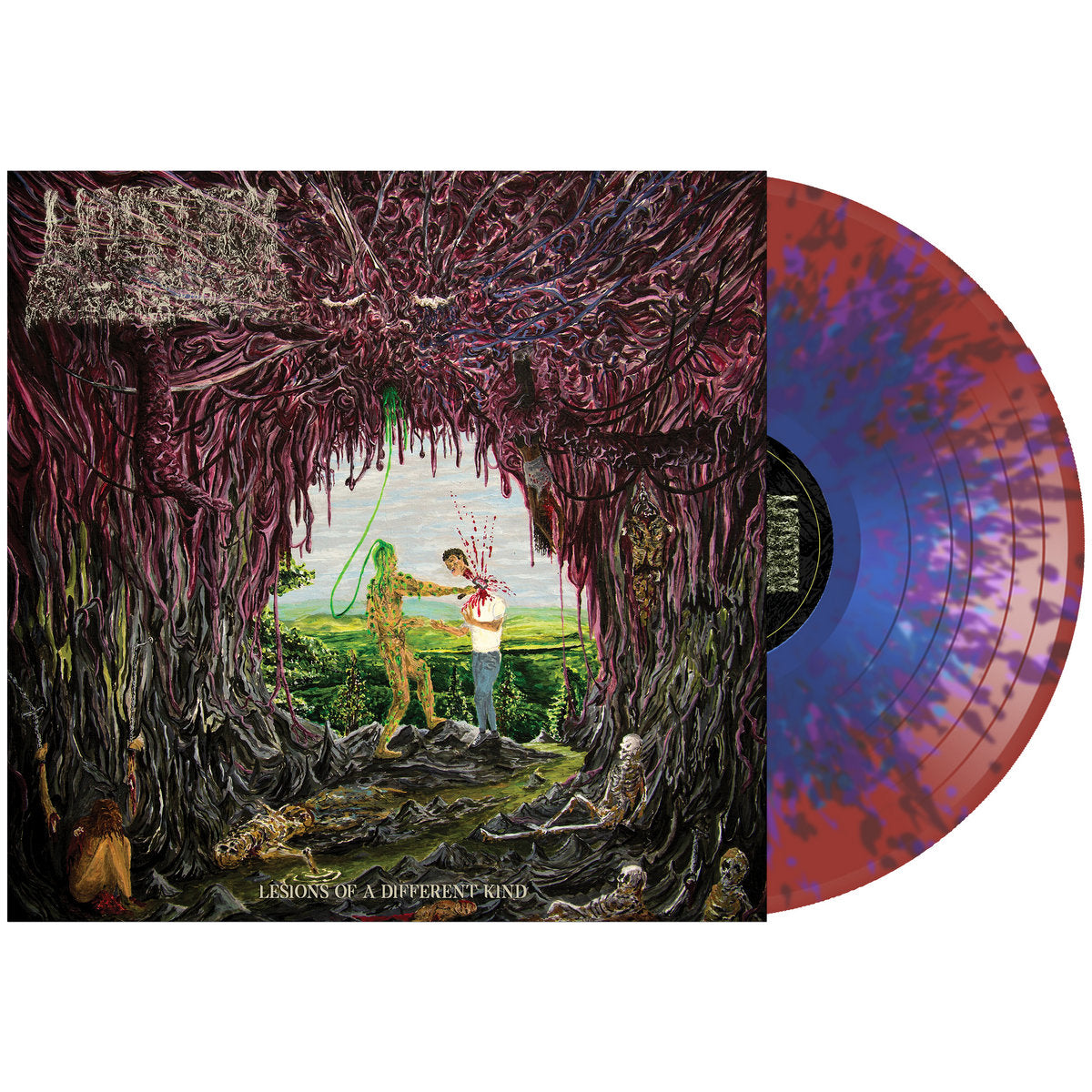 UNDEATH 'LESIONS OF A DIFFERENT KIND' LP - CLEAR/DARK RED/LIGHT BLUE/SPLATTER