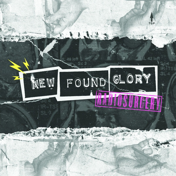 NEW FOUND GLORY 'RADIOSURGERY' 7" SINGLE - COLOR