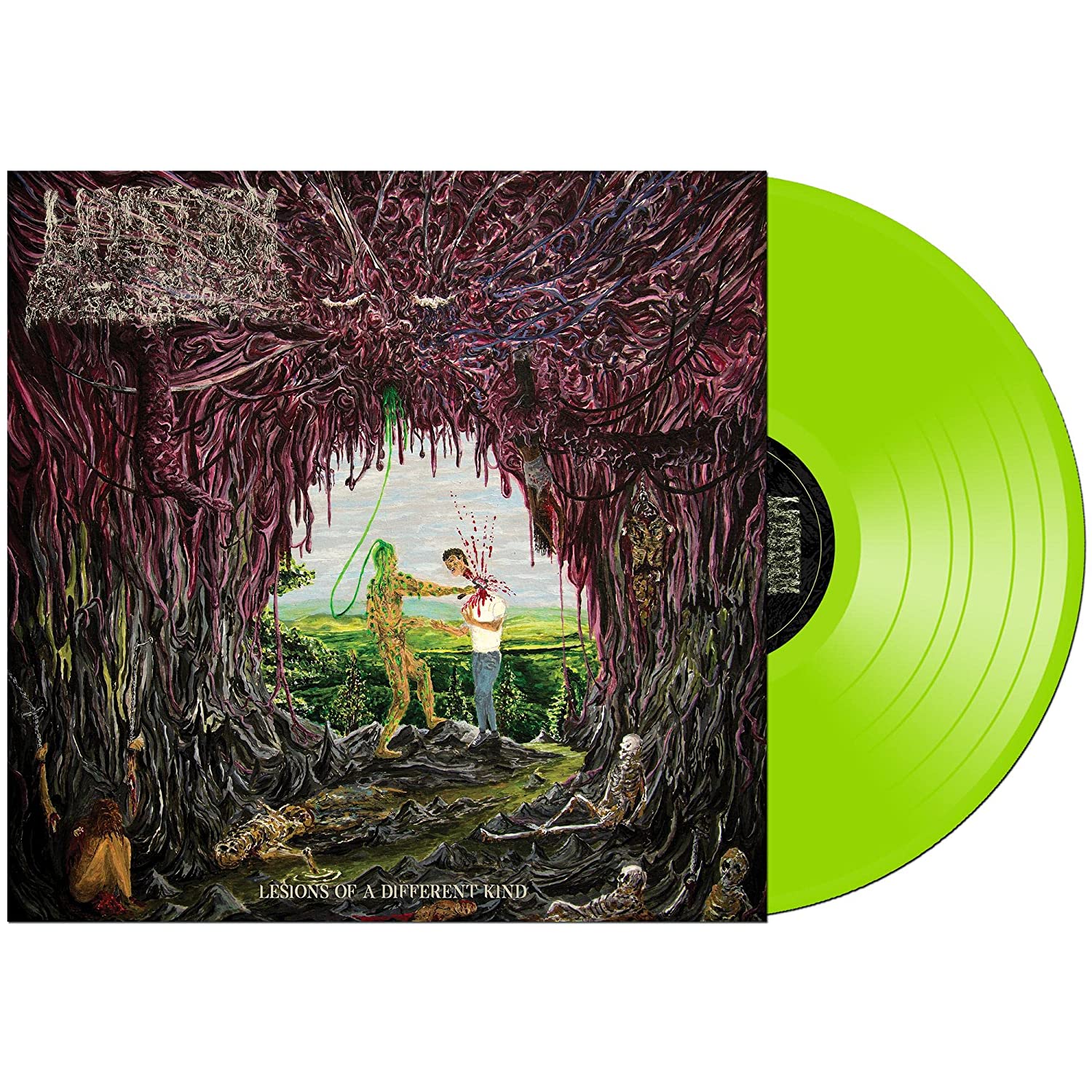 UNDEATH 'LESIONS OF A DIFFERENT KIND' LP - GREEN